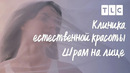 Шрам на лице | Клиника естественной красоты | TLC