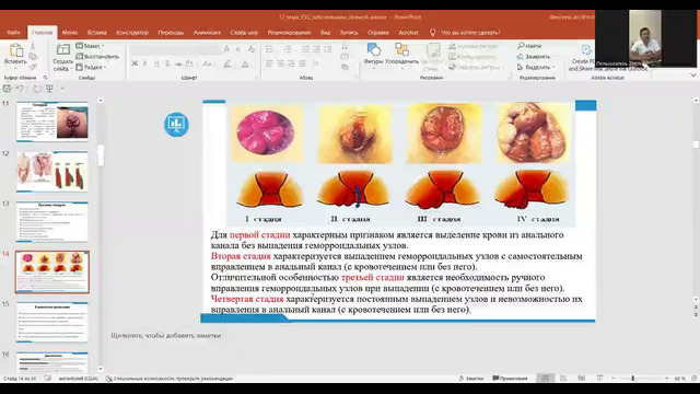 Unit 25. Тема 13. Заболевания прямой кишки