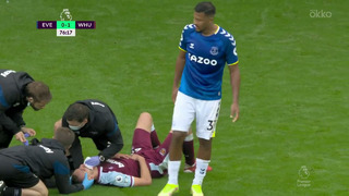Жуткая травма Соучека в матче «Эвертон» – «Вест Хэм»