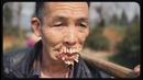 5 реальных людей мутантов