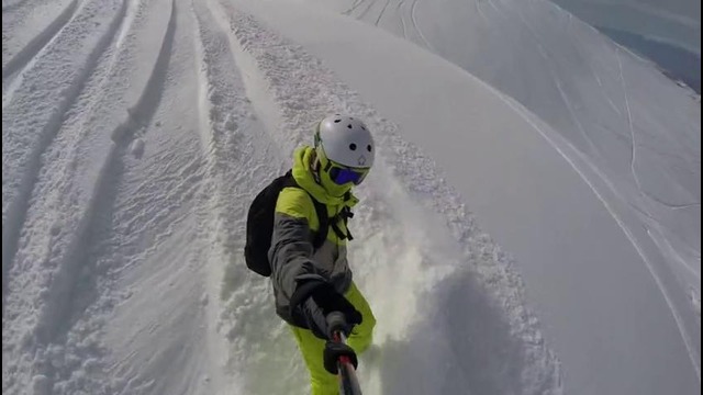 Как я получил свой первый гипс