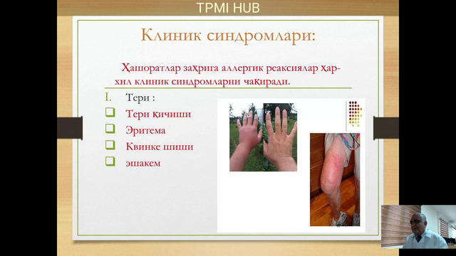 Аллергология. Инсект аллергия