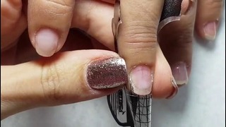 Bitten nails Problem cuticle