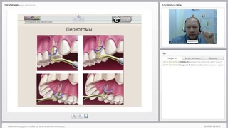 Вебинар: Атравматичное удаление зубов для одномоментной имплантации