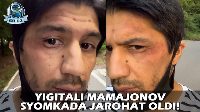 Йигитали Мамажонов съёмкада жароҳат олди! | Yigitali Mamajonov syomkada jarohat oldi