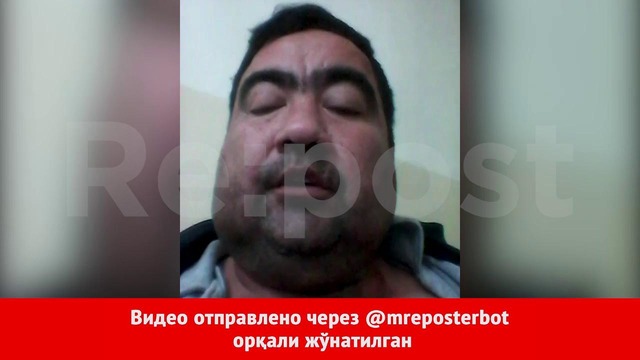 Поджегший себя у здания хокимията узбекистанец записал видеообращение
