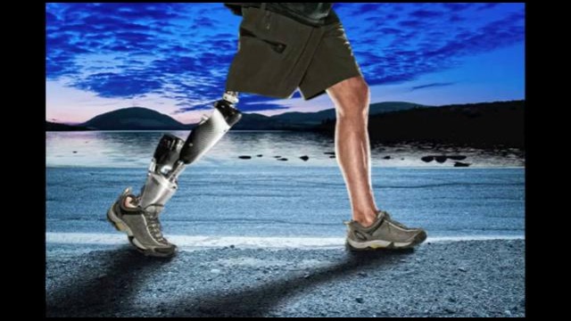 Бионический протез ноги от iWalk