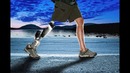 Бионический протез ноги от iWalk