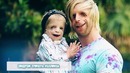 10 детей, которые родились с редчайшими телесными аномалиями