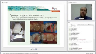 Вебинар: Этапы эволюции стоматолога терапевта-от пломбы до реставрации