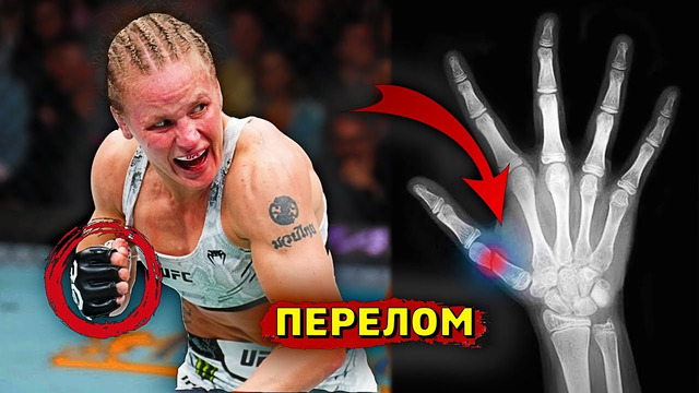 Этого не заметили! Ужасная травма Валентины Шевченко в поединке с Алексой Грассо на UFC/Звуки ММА