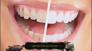 Как отбелить Зубы в Домашних условиях