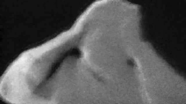 Extermination Dismemberment – The Final Verdict (Official Video 2026)