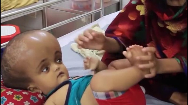Ребенок с огромной головой ждет спасения у врачей. Рожденные другими