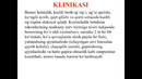 Botulizm kasalligida hamshiralik ishi зоом